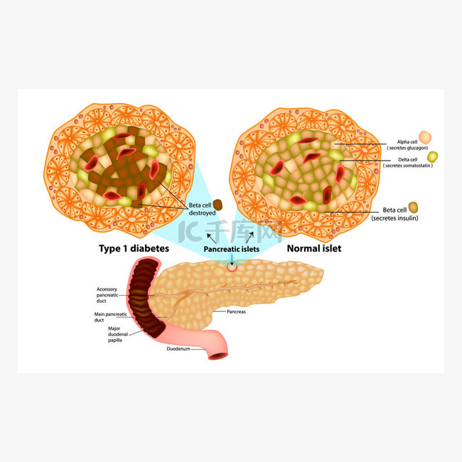 胰腺有许多胰岛, 含有胰岛素生