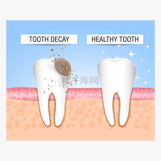 健康和患病牙齿的概念。为学生、