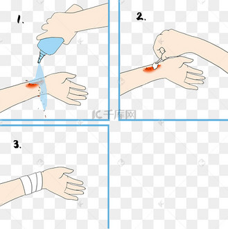 医疗包扎伤口步骤