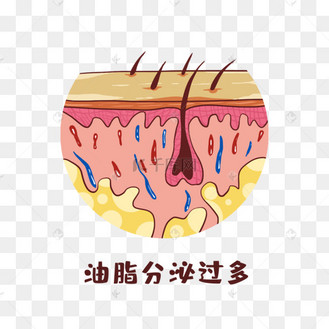 医学医疗保健皮肤油脂分泌过多
