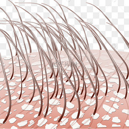 头发白色头皮屑