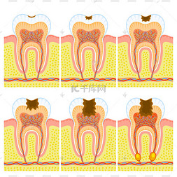 牙齿的内部结构