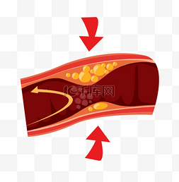 人体艺丝袜术图片_人体器官血管