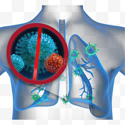 x光片图片_冠状病毒感染肺炎现实3d元素