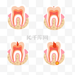 牙疼图片_医用牙齿