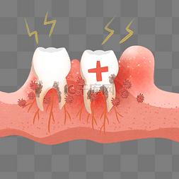 日常炎症图片_牙龈出血牙周炎