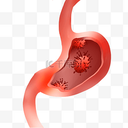 胃痛胃胀图片_肠胃胃癌