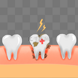 牙周炎患病率图片_牙齿松动