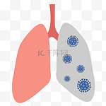 肺部感染病毒