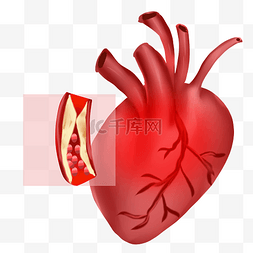 人体透视结构图片_人体内脏疾病心梗