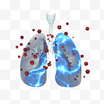 新冠病毒感染肺部透视图