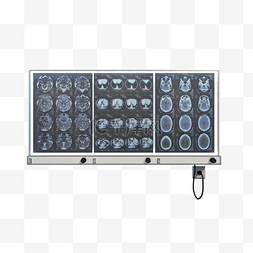 医疗x光图片_仿真x光显示机png图