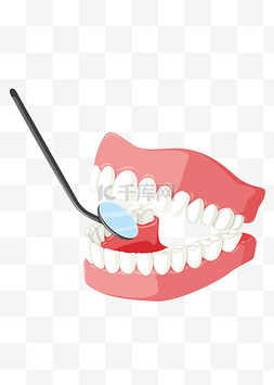 牙科口腔镜