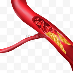 人体器官血管图片_血栓血液红色血管