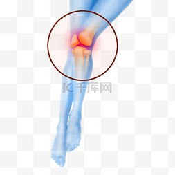 医疗膝关节疼痛