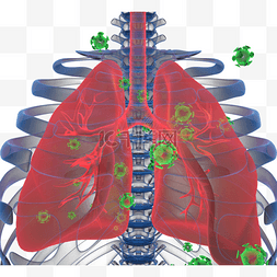 预防肺炎病图片_冠状病毒肺炎骨X线胶片3d元素