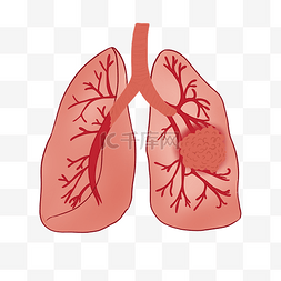 吸的肺部图片_肺部肺炎肺癌