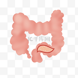 结肠癌器官