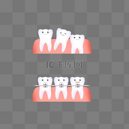 口腔溃疡药图片_口腔牙齿整牙