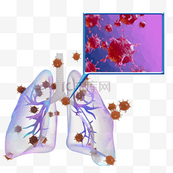 3d冠状病毒感染肺炎元素