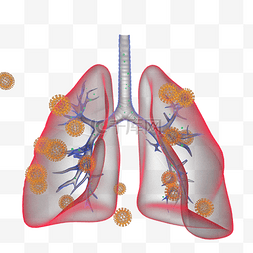 口罩肺炎图片_冠状病毒性肺炎治疗3D立体元素