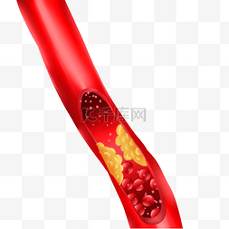 人体器官血管图片_血液血栓血管