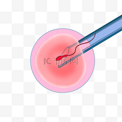 氨基酸注射液图片_试管婴儿胚胎
