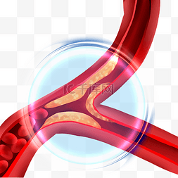 人体血管分布图图片_心血管血管堵塞