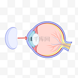 预防视力图片_预防近视保护视力