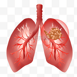 吸的肺部图片_肺部恶性肿瘤