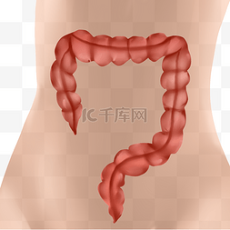 肠道图片_大肠癌生病癌症