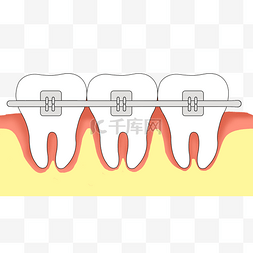 正畸对比图片_牙齿矫正牙齿正畸