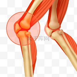 膝关节疼痛疾病