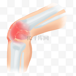 足部疼痛图片_膝关节关节炎疼痛