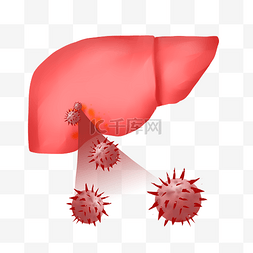 病毒性肝炎图片_肝脏肝炎感染