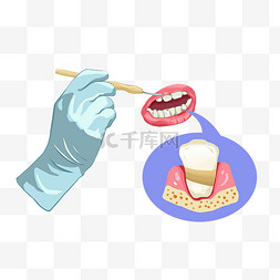 治疗牙齿图片_牙周炎治疗口腔
