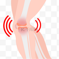 x光片膝盖图片_膝盖痛骨骼