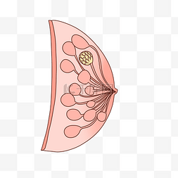 胆囊肿瘤图片_诊治的乳腺肿瘤