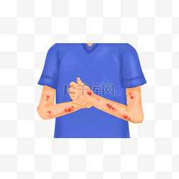 伸出手臂的男人图片_手臂上的荨麻疹
