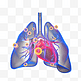 冠状肺炎X射线胶片3d元素