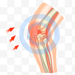 关节痛骨骼图片_膝盖痛受伤