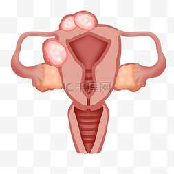 女性子宫图片_妇科病生卵巢癌癌症