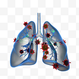 x光片图片_冠状病毒性肺炎治疗3d元素