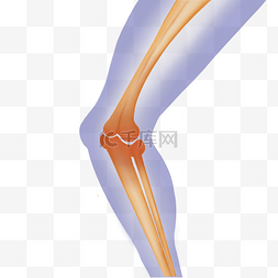 x光片膝盖图片_膝盖疼痛酸痛