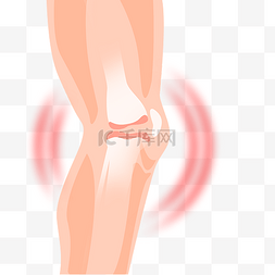 膝盖症状图图片_膝盖拉伤受伤