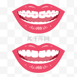 牙齿牙医图片_微笑大笑牙齿笑容开心搞笑露齿笑