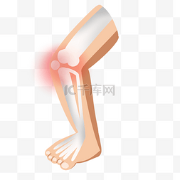 关节炎图片_骨质疏松日大腿骨关节
