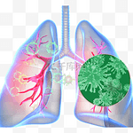 新的冠状病毒性肺炎