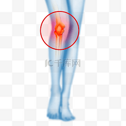 膝盖关节图片_膝盖关节疼痛