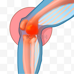 膝盖膝关节疼痛